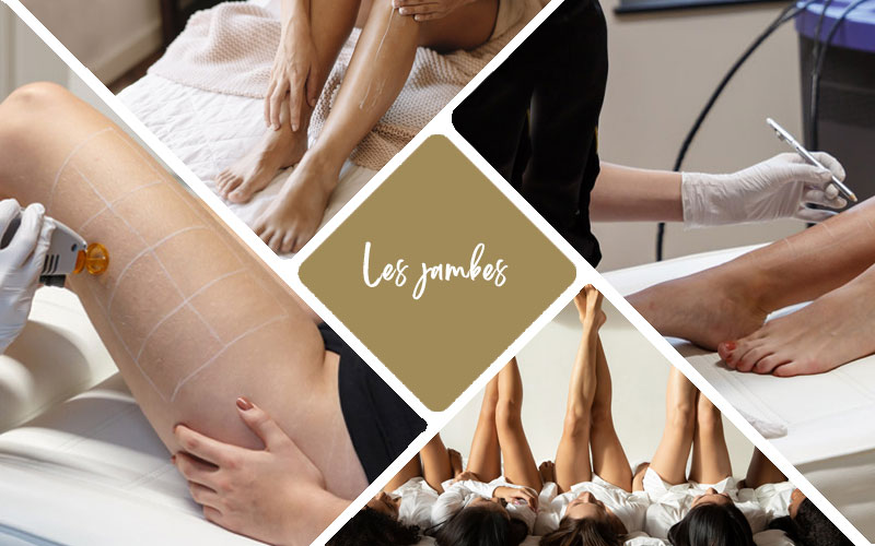 epilation laser jambes